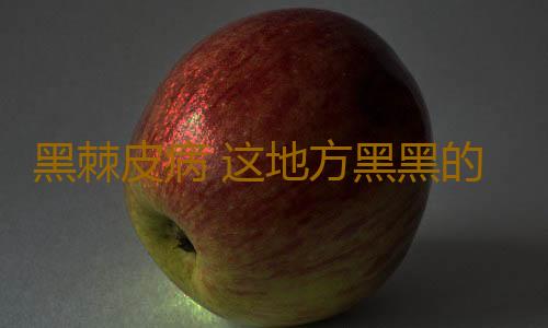 黑棘皮病 这地方黑黑的洗不干净竟是患病了